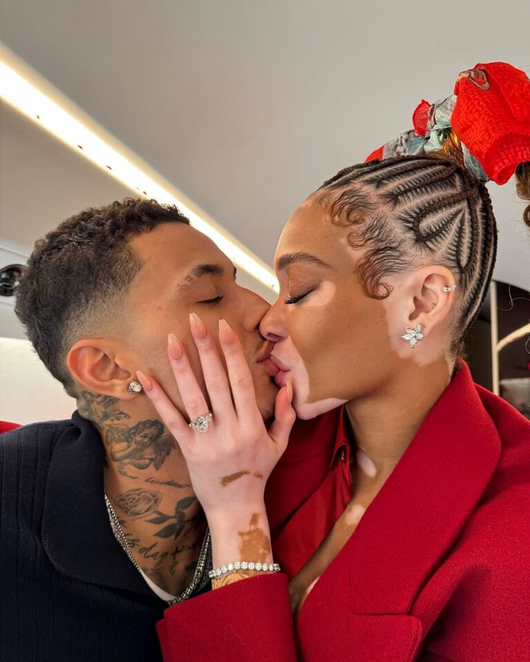 Soak in the Love Story of Winnie Harlow & Kyle Kuzma as They Announce Their Engagement Soak in the Love Story of Winnie Harlow & Kyle Kuzma as They Announce Their Engagement