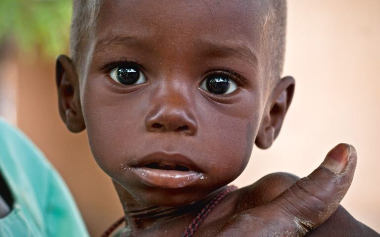 Food Inflation Drives 3.5m Children into Malnutrition