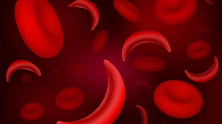Senegal’s $7.1m sickle cell drug push targets six African markets Senegal’s $7.1m sickle cell drug push targets six African markets
